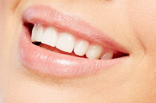 Facette dentaire à Villemomble – Blancpro